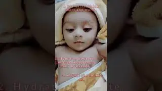 How to treat dry skin in babies#babycare #shorts #baby