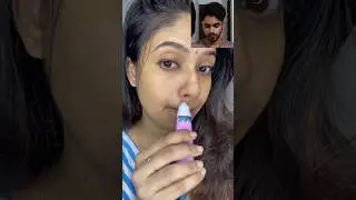 Plix പിന്നെയും ചതിച്ചു guys 😭🥴😭reality of Plix acne spot corrector #shorts