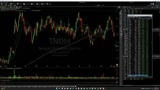 $TNDM Stock Price Action