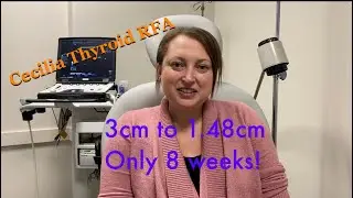 Thyroid RFA patinet Cecilia interview with  Sean Nikravan, MS