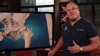 Dr. Mark Adickes: How do you treat snapping hip?