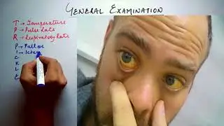 General Examination Key Points | Clinical Medicine | AK's Medicology