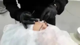 Subincis&atilde;o para Toxina Botul&iacute;nica Durar Mais!