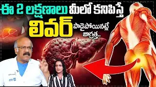 Dr Nageshwar Reddy About Causes of Liver Failure | #liver | SumanTV
