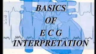 ECG BASICS MADE EASY | MASTER ELECTROCARDIOGRAM IN MINUTES (BEGINNER TO PRO) | CARDIOLOGY | USMLE
