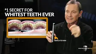 #1 Secret for Whitest Teeth Ever- Shine & Brighten Your Smile like Never Before w/ This One Product