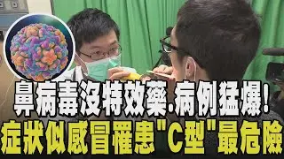 鼻病毒病例激增! 歌神陳奕迅也患過 沒特效藥症狀像感冒
