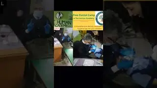 Dental treatment camp#childsmile#kids dental health