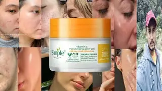 Simple Vitamin C Moisturiser Glow Gel | Honest Review