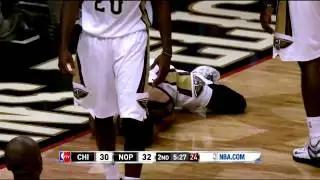Anthony Davis Shocking Injury | Bulls vs Pelicans  | February 7, 2015   NBA Season 2014 15