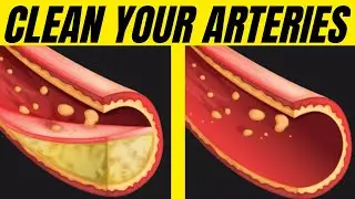 15 Best Cholesterol Lowering Foods for Lowering Bad (LDL) Cholesterol | Be Nutritive |