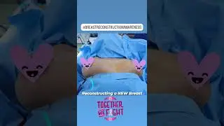 Breast Reconstruction post mastectomy/ breast cancer treatment | Best cosmetic clinic Bengaluru