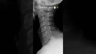 RADIOLOGY 🥼 #radiologystudent #anatomy #humanskull#medicalimaging #medicaltest#hospital #humanskull
