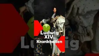 Der Sonnenk&ouml;nig und seine Krankheiten🤢