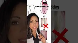 How to STOP Bad Breath in Kids 🤮 at the Source! Pediatric Dentist Tips