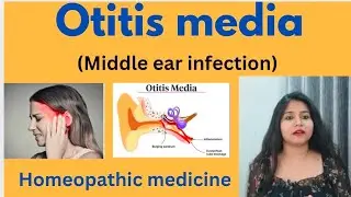 Otitis media (middle ear infection) treatment ! Ear infection symptoms,cause & homeopathic medicine