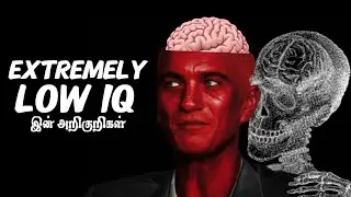 &ldquo;இந்த 6 பழக்கங்கள் இருந்தா&hellip; IQ குறைவு தெரியாமலே வெளிப்படும் | Psychology Tamil&rdquo;