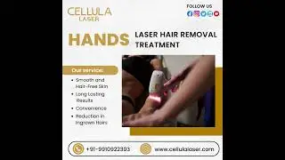 Hands Laser Hair Removal Treatment in Ghaziabad