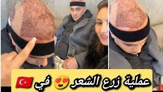 جمعة مباركة❤️ شوفو ريبوح كيفاش راهو فرحان باعملية زرع الشعر😍🤩