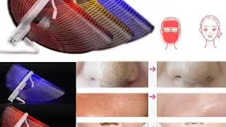 3 COLORS LED PHOTON THERAPY MASK SKIN REJUVENATION ANTI-WRINKLE PORE ACNE TREATMENT USB FACIAL MASK&hellip;
