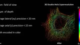 Single Molecule Localisation Microscopy