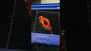 #Lysotracker #3D #Super Resolution microscope
