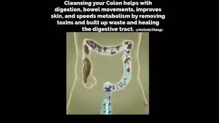 Colon Cleansing. (Eliminating Years Of Accumulated Body Waste)