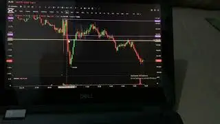 My Options Trade Journal: DAY 1️⃣ ~ lost $10 on PLTR❌