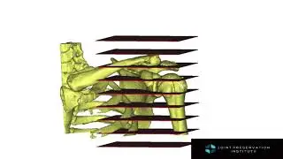 Understanding Your Medical Images: Xrays, CT scans, and MRI Images
