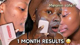 ЭТО МЕНЯ УДИВИЛО | Результаты использования мыла Topicals Faded Bar Soap за 1 месяц