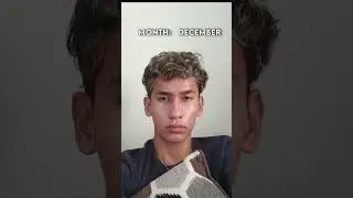 10 Month Hair Growth Post Buzz Cut