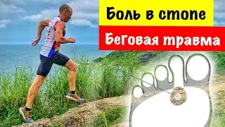 Боль в плюснефаланговом суставе. Беговые травмы.