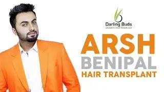 Punjabi Singer gets a hair transplant | Darling Buds Clinic | Arsh Benipal
