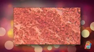 Red Blood Cell Under Microscope