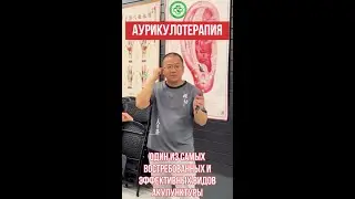 👂 Ушная акупунктура #иглоукалывание
