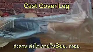 Cast Cover Leg/เดอะเบสศิริราช 084-6581187หรือ 089-4799822