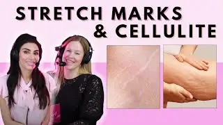 Stretch Mark REMOVAL, Cellulite TREATMENT & More! | More Than A Pretty Face Podcast