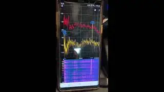 2021 Nissan Sentra makes high frequency noise - hearing damage - malfunctioning brand-new car!