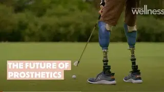 The future of prosthetics