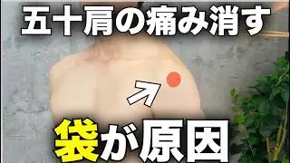 五十肩の痛みの原因は「袋」だった。