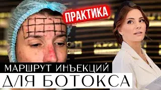 Расставляем маршрут инъекций для ботокса правильно