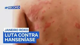 Brasil &eacute; o segundo pa&iacute;s com mais casos de hansen&iacute;ase no mundo