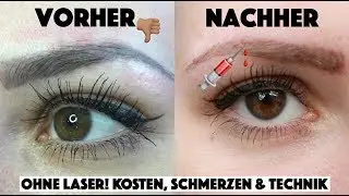 VERPFUSCHTES PERMANENT MAKE-UP ENTFERNEN OHNE LASER - KOSTEN, SCHMERZEN & TECHNIK