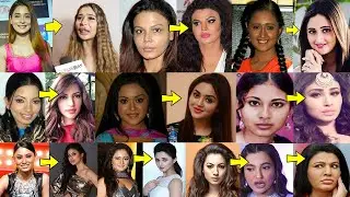 Top 8 TV Actresses Who Looks Horrible After Plastic Surgery | Before And After of Plastic Surgery