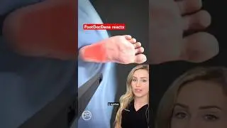 Врач объясняет: операция по удалению подошвенного фасциита