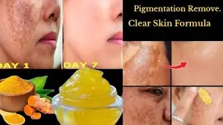 How To Use Turmeric Cream for Dark Spots | Haldi, Aloe Vera Gel & Vitamin E Whitening Cream