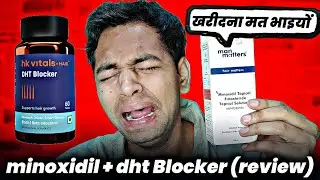 Minoxidil Side Effects | Man matters minoxidil review| how to use minoxidil for hair and beard grow.