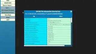 Soteria DcmRecons  02 DICOM Tags