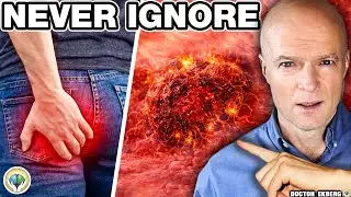 10 Early Colon Cancer Signs You Should Never Ignore