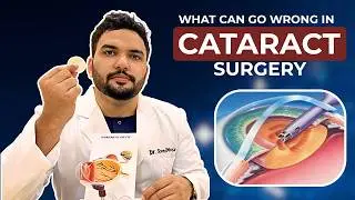 4 Things That Can Go Wrong in a Cataract Surgery? | Tamil | Dr. Syed Moosa | Eye Doctor |